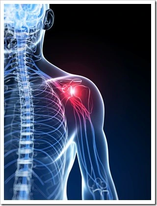Frozen Shoulder Explanation at TheChiro Bukit Jalil